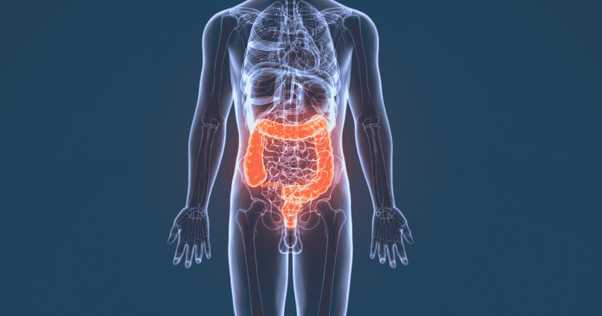 A transparent X-ray style illustration of the human body highlights the large intestine in glowing orange