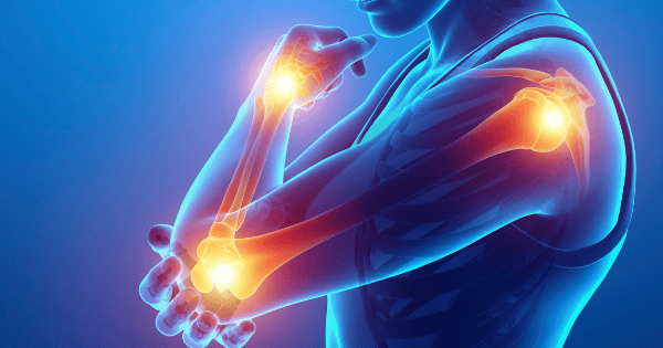 An 3D anatomical illustration highlights joint pain with glowing red and yellow zones on a person's shoulder, elbow, and wrist.